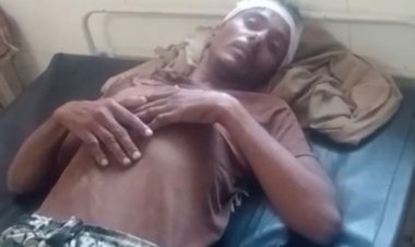 रास्ते के विवाद में पिता-पुत्र पर हमला, दोनों गंभीर:सीधी जिले के कुर्रेवाह में महिला समेत तीन लोगों ने किया डंडों से हमला